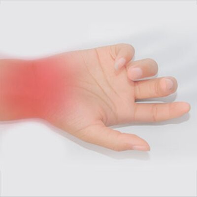 csm_Neurochirurgie_Lippstadt_Dr_Peter_Vomhof_Handgelenk_b6596323cf